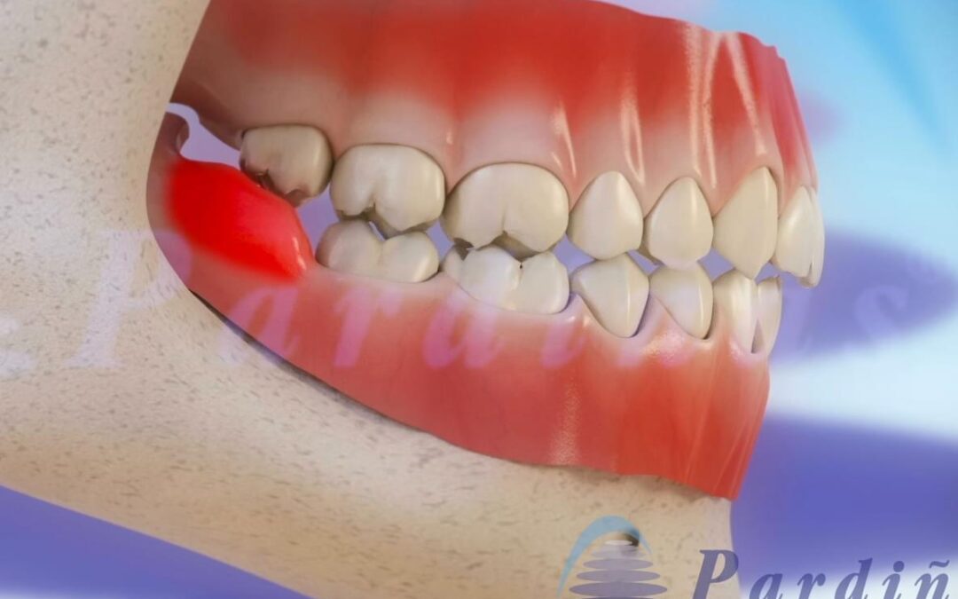 3Dentista, tratamientos de odontología en vídeo 3D