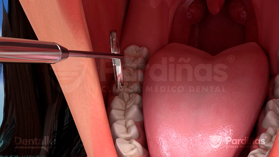 Revisión de la boca en el dentista