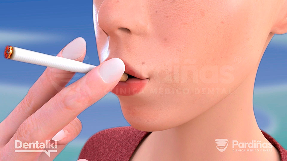 El tabaco perjudica a la salud bucodental y a la salud general